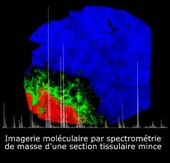 Imagerie moléculaire par spectrométrie de masse d'une section tissulaire mince